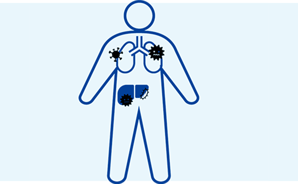 全てのがんが治療対象