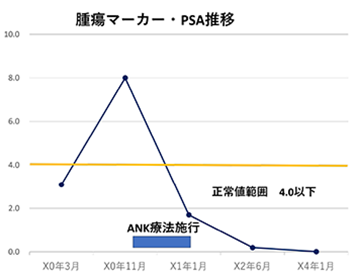 前立腺がん