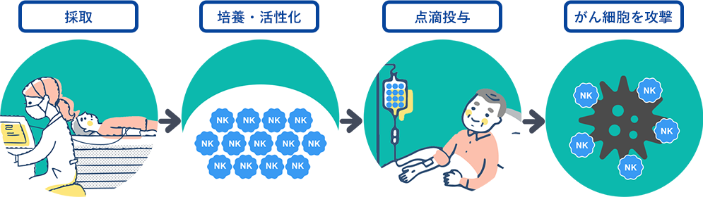 採取→培養・活性化→点滴投与→がん細胞を攻撃