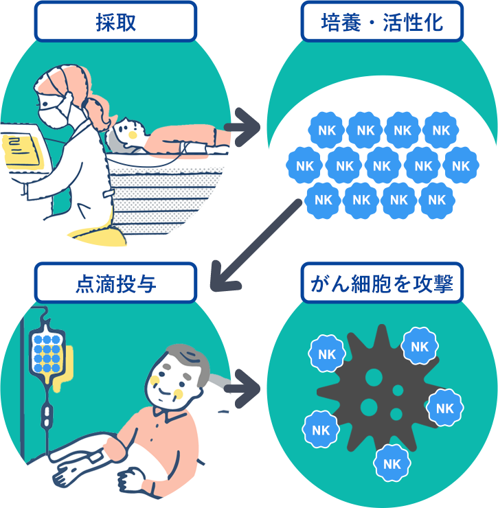 採取→培養・活性化→点滴投与→がん細胞を攻撃